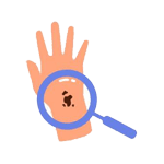 Skin Cancer Screening