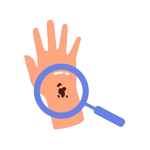 Skin Cancer Screening